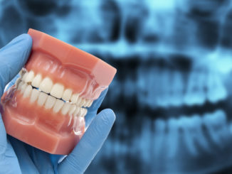 Скрежет зубами часто диагностируют у детей, хотя и взрослые бывает страдают от него. Симптом появляется по ряду причин, в том числе из-за особенностей физиологического развития, психоэмоционального состояния или как следствие заболевания, например, глистной инвазии.